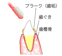 歯みがきの練習