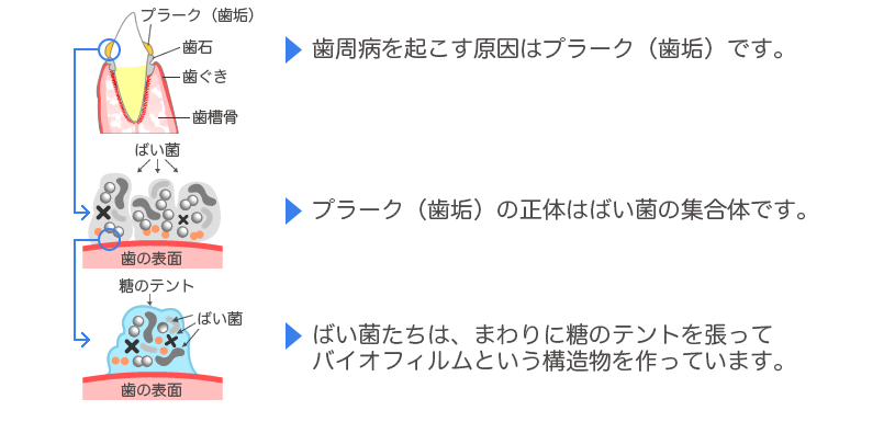 プラークの正体