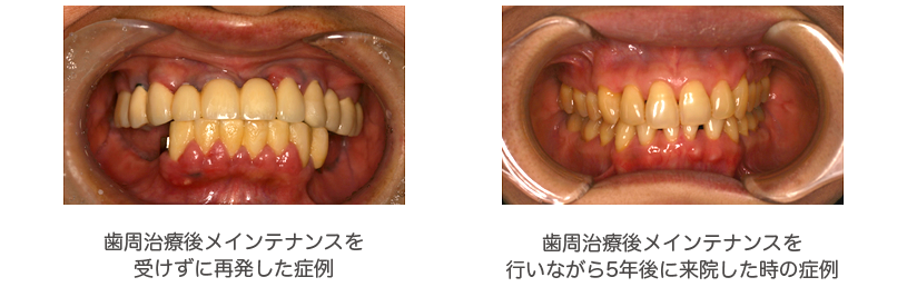 メインテナンスの有無による比較