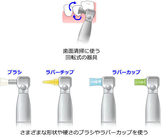 歯面清掃器具