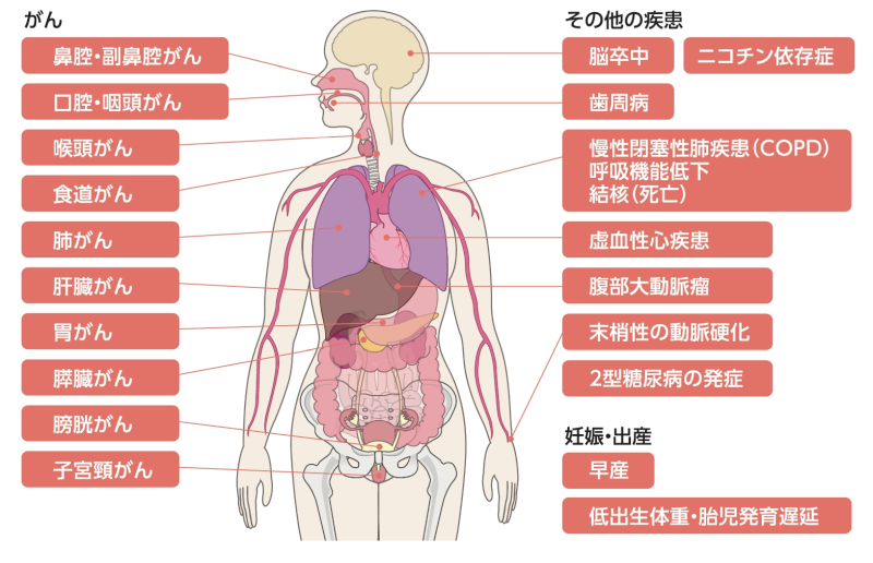 たばこを吸っている本人はこんな病気になりやすくなる（根拠十分：レベル1）