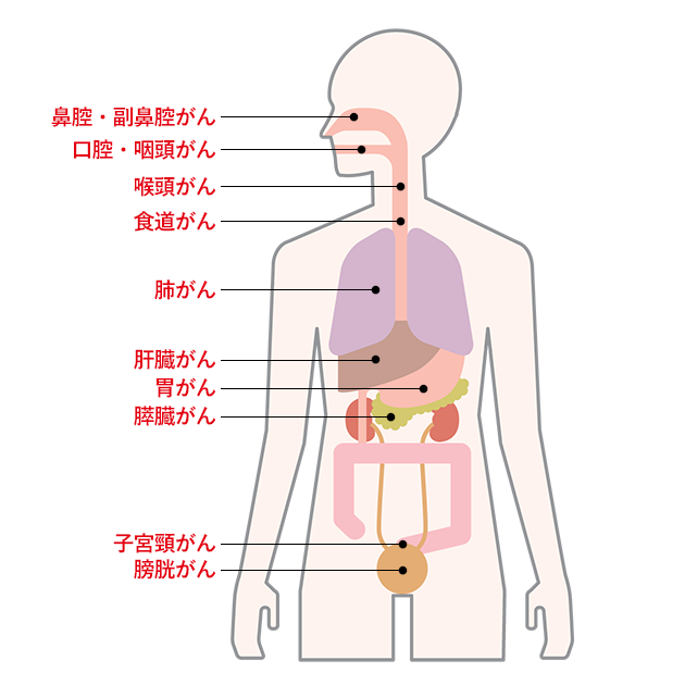 喫煙している人がなりやすいがん