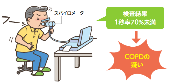 検査結果1秒率70％未満 COPDの疑い
